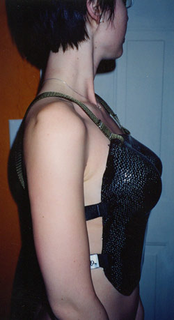 Carbon fiber corset